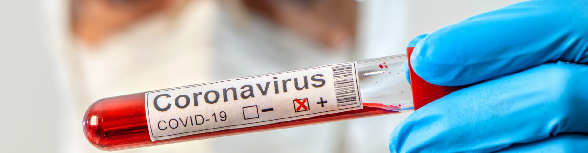 Nextgen Healthcare Blog Does the Quality of the Test Matter? 